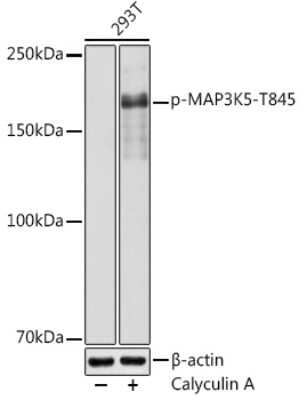Western Blot: ASK1 [p Thr845] Antibody [NBP3-16949] - Western blot analysis of extracts of 293T cells, using ASK1 antibody (NBP3-16949) at 1:1000 dilution.293T cells were treated by Calyculin A (100 nM) at 37C for 30 minutes after serum-starvation overnight. Secondary antibody: HRP Goat Anti-Rabbit IgG (H+L) at 1:10000 dilution. Lysates/proteins: 25ug per lane. Blocking buffer: 3% nonfat dry milk in TBST. Detection: ECL Basic Kit. Exposure time: 1s.